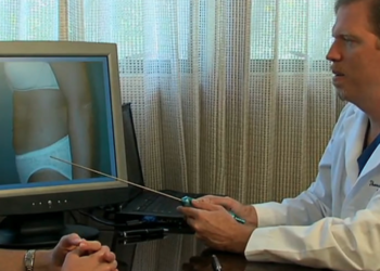 How Would You Compare Traditional Weight Loss to Liposuction?